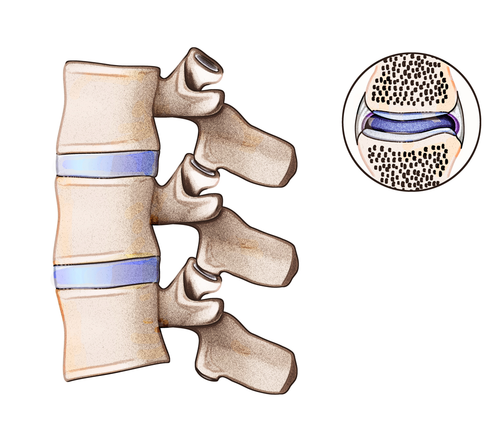 stock-photo-facet-joints-labeled-157672247