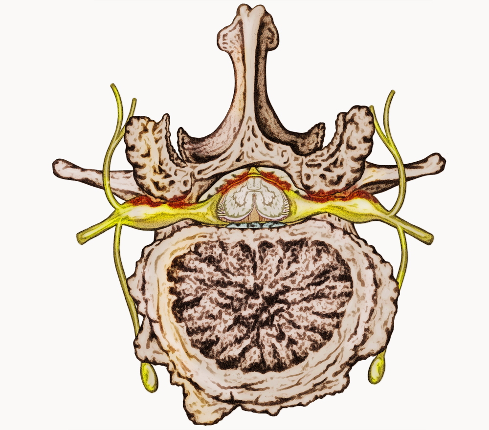 stock-photo-spine-pain-and-lower-back-disease-and-human-backache-with-a-three-dimensional-spinal-body-skeleton-318640694